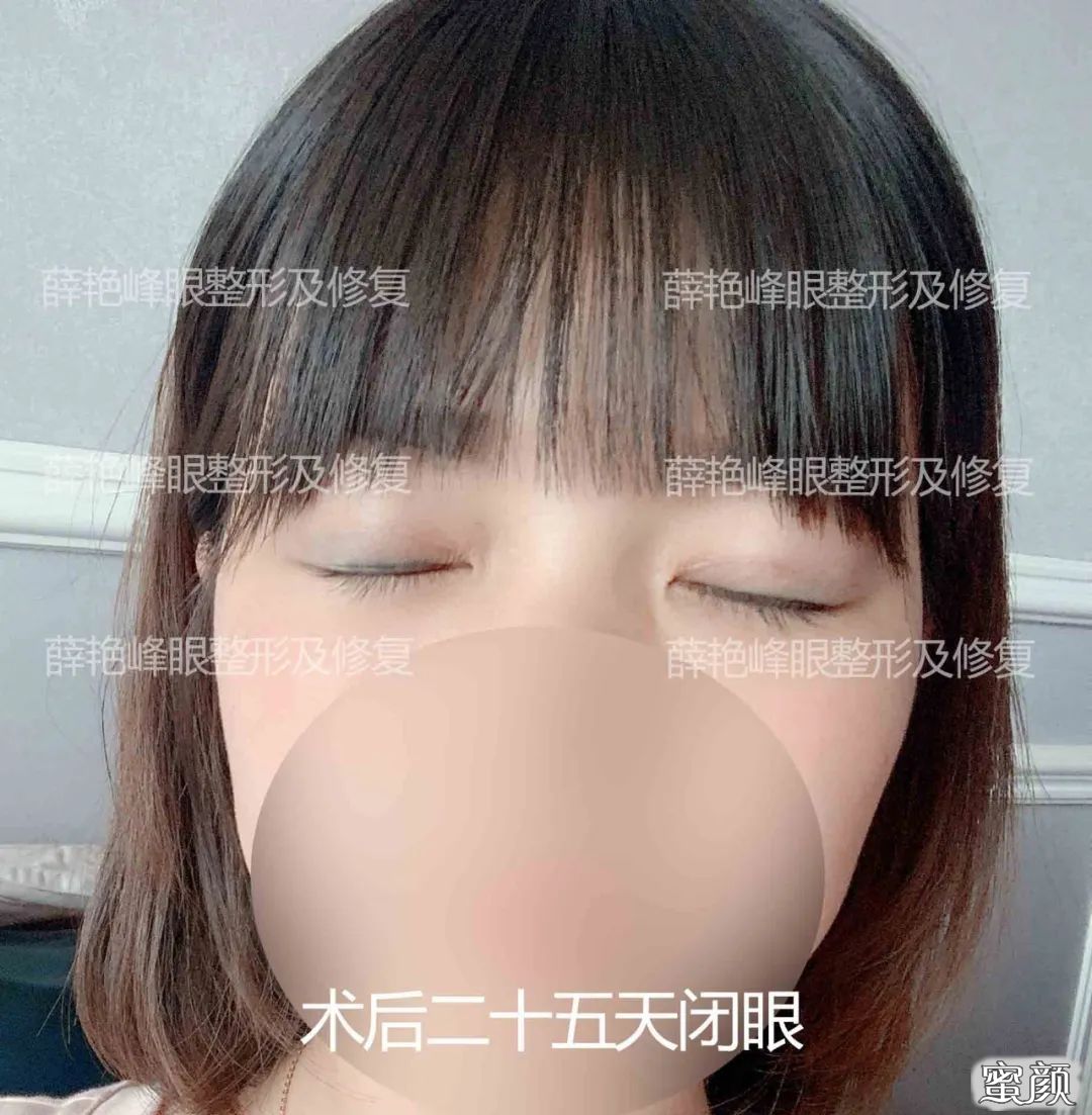 案例图片