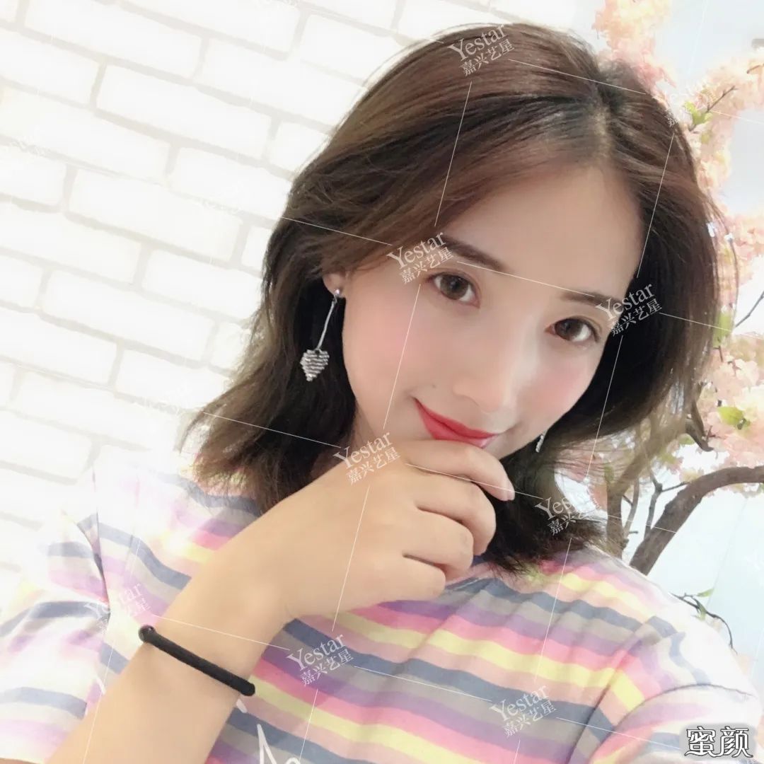 https://img.yiyiaimei.com/mnt/timg/200506/130404OM-7.jpg 案例图片