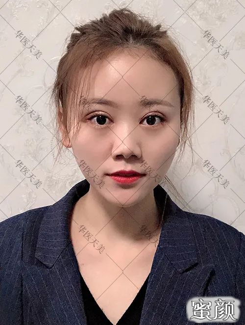 案例图片
