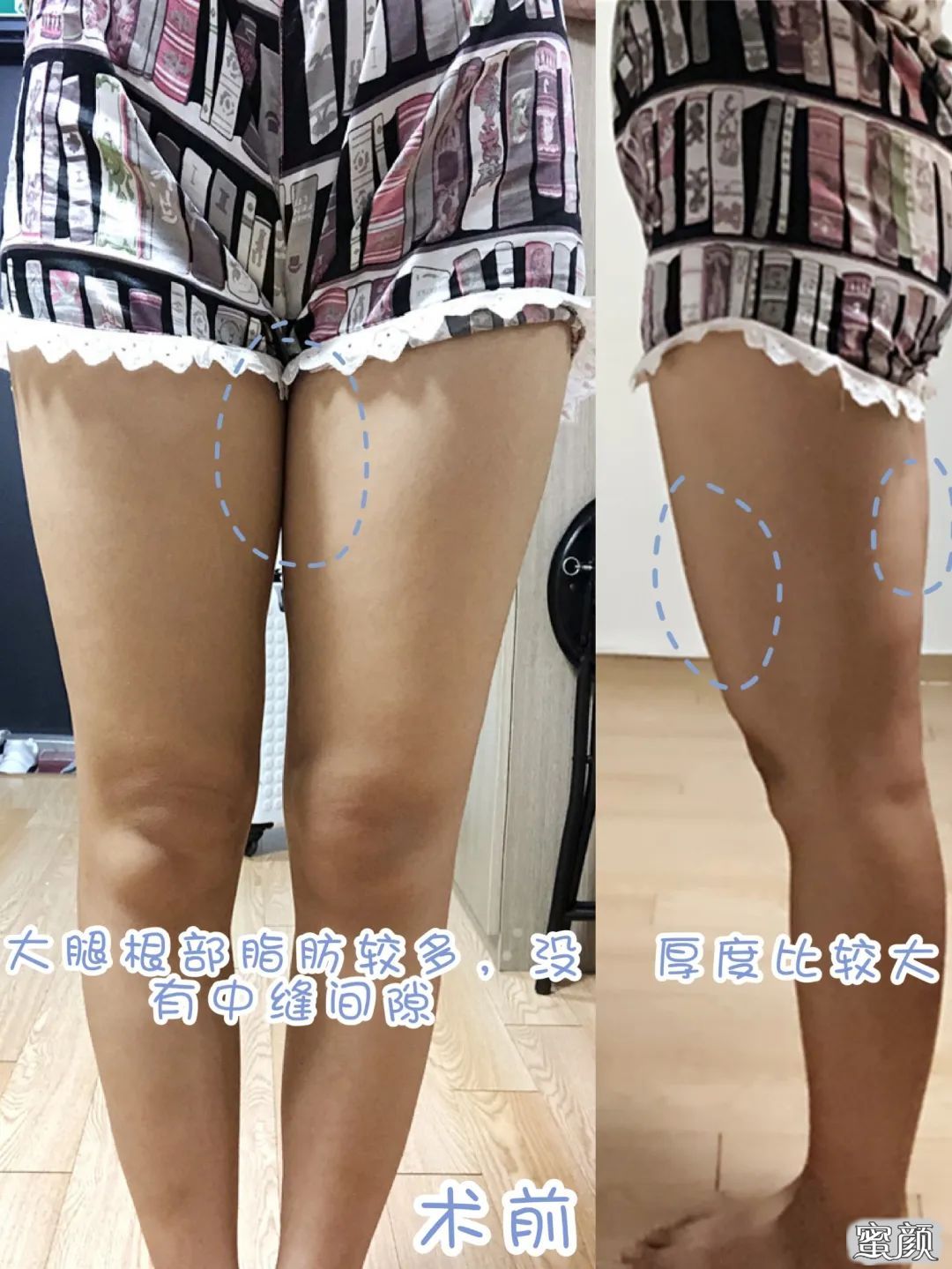 https://img.yiyiaimei.com/mnt/timg/200506/13200244X-4.jpg 案例图片