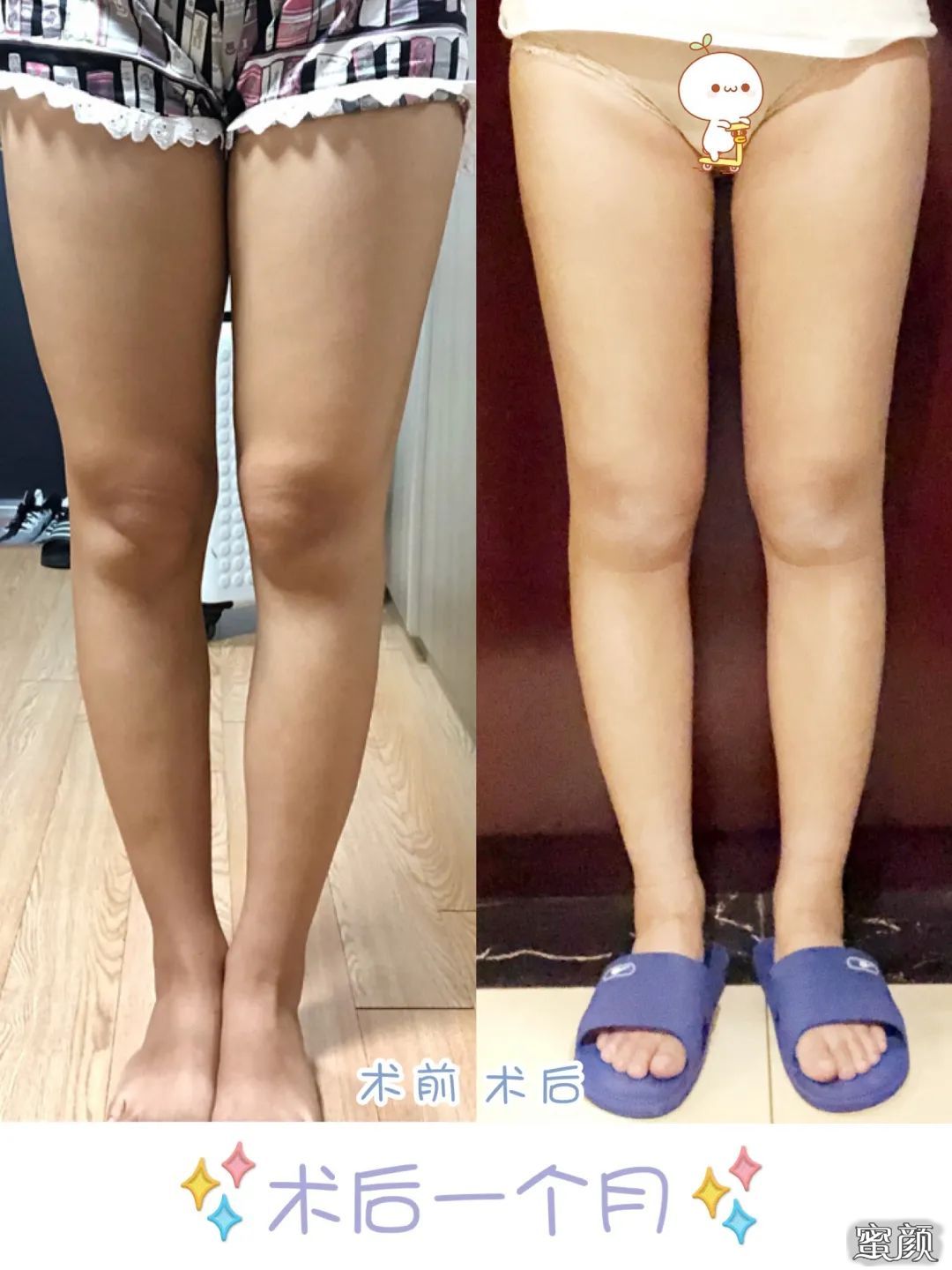 https://img.yiyiaimei.com/mnt/timg/200506/13200J5W-7.jpg 案例图片