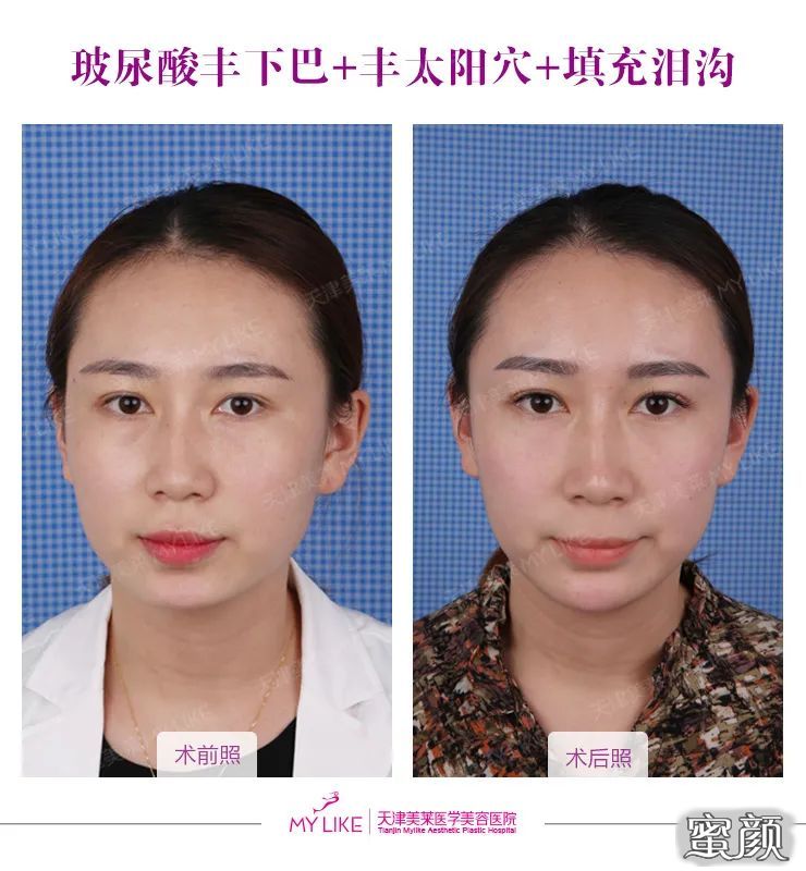 https://img.yiyiaimei.com/mnt/timg/200506/135U443I-1.jpg 案例图片