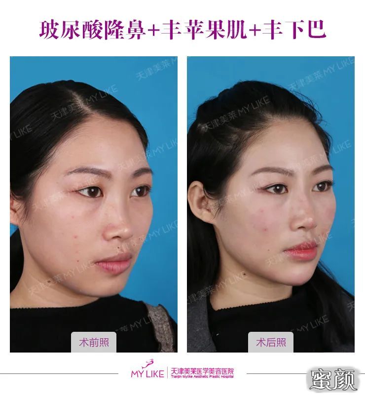 案例图片