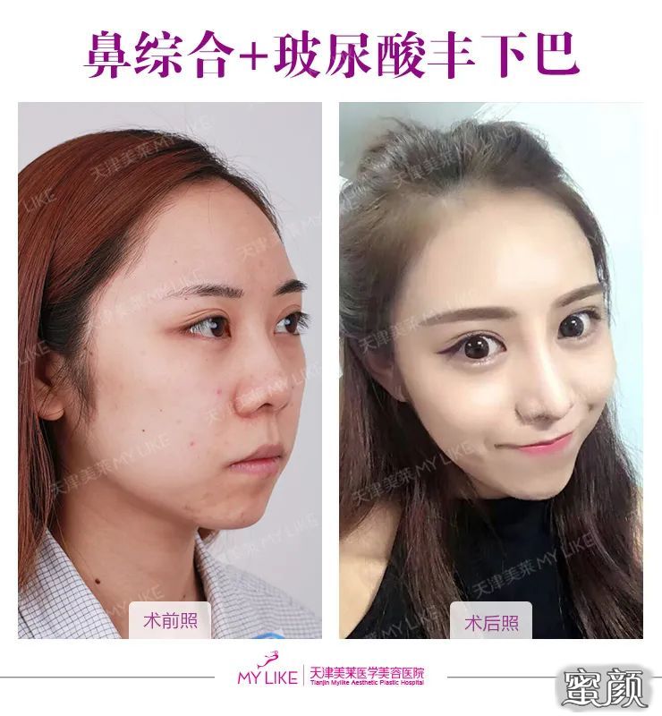 案例图片
