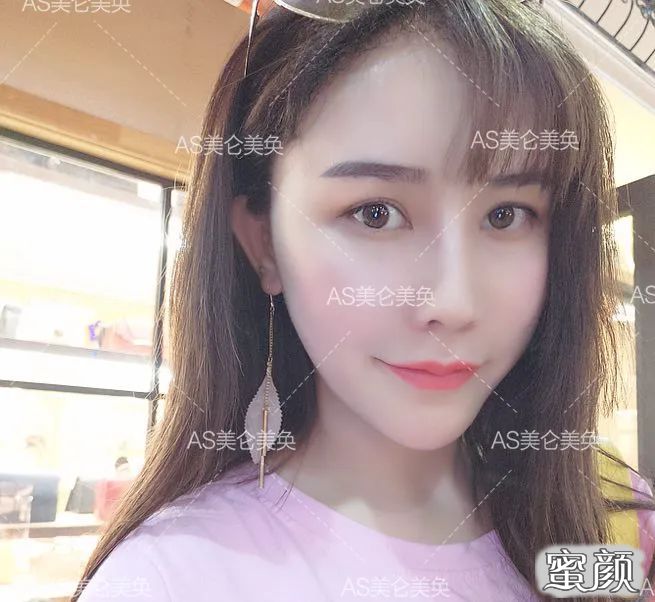 案例图片