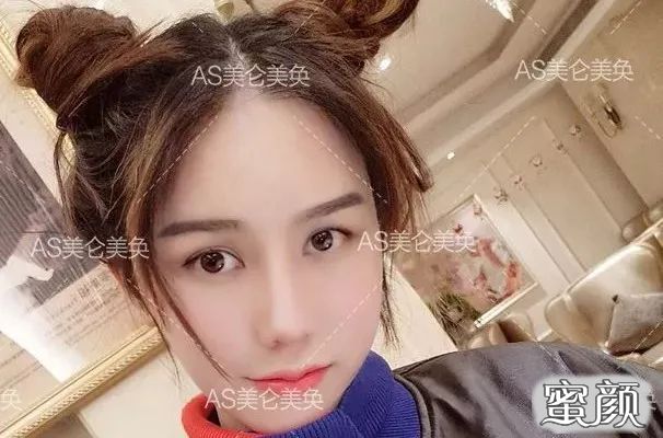 案例图片