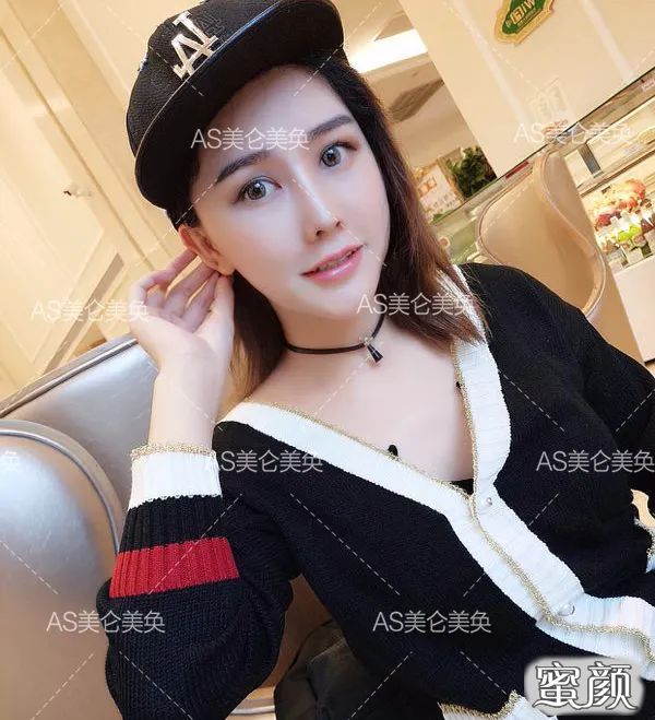 案例图片