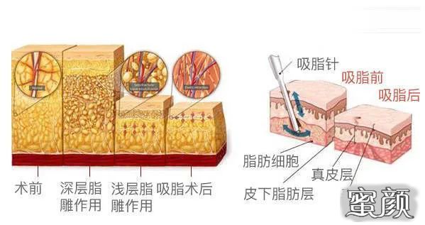 https://img.yiyiaimei.com/mnt/timg/200506/145F525c-3.jpg