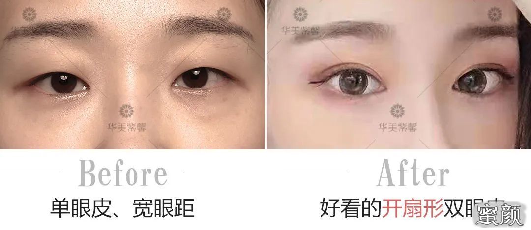 https://img.yiyiaimei.com/mnt/timg/200507/13151943I-3.jpg