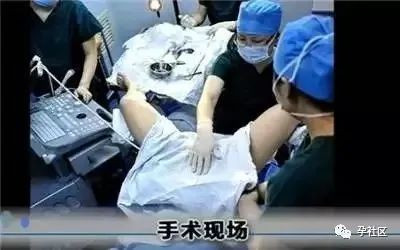 案例图片