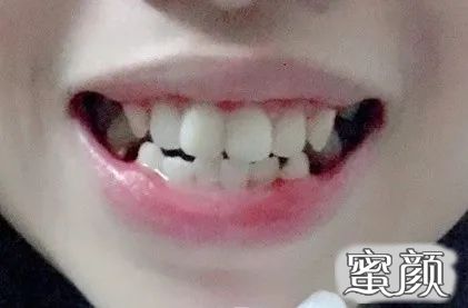 案例图片