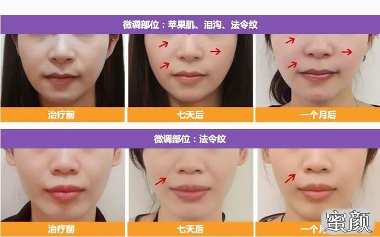 https://img.yiyiaimei.com/mnt/timg/200507/1420454619-0.jpg 案例图片