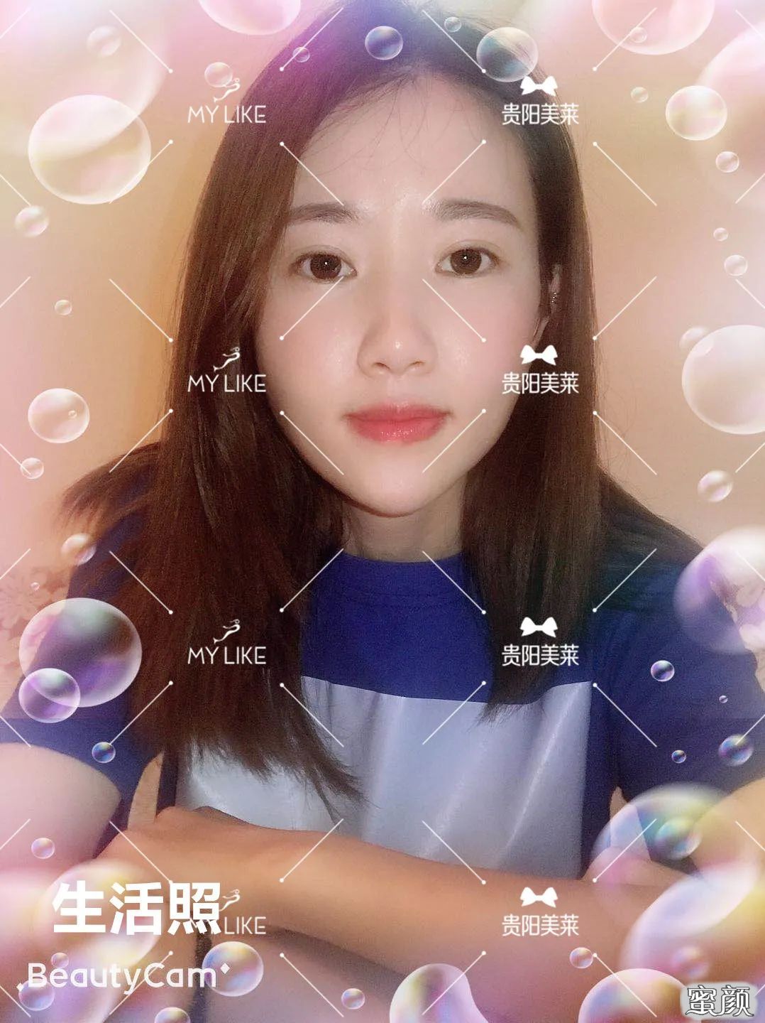 https://img.yiyiaimei.com/mnt/timg/200507/1420505P4-3.jpg 案例图片