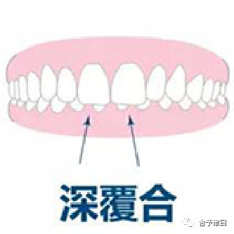 https://img.yiyiaimei.com/mnt/timg/200507/14411G441-0.jpg 案例图片