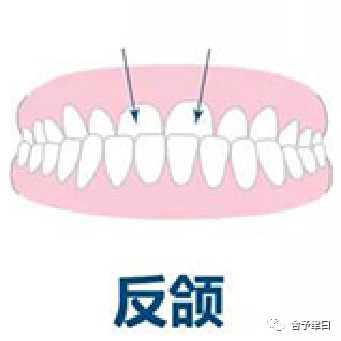 https://img.yiyiaimei.com/mnt/timg/200507/14411T424-1.jpg 案例图片