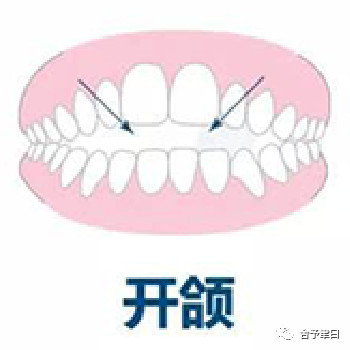 https://img.yiyiaimei.com/mnt/timg/200507/14411WE6-2.jpg 案例图片