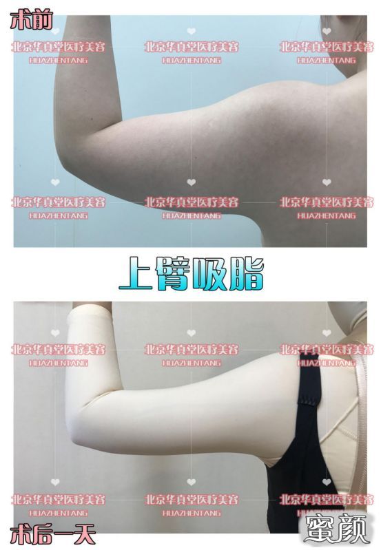 案例图片