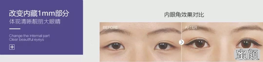 https://img.yiyiaimei.com/mnt/timg/200508/134I36029-13.jpg