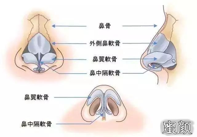 案例图片