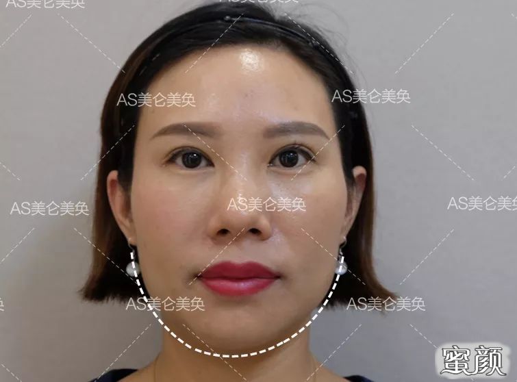 https://img.yiyiaimei.com/mnt/timg/200508/1459364T1-8.jpg