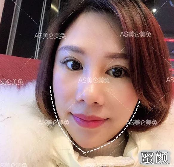 https://img.yiyiaimei.com/mnt/timg/200508/1459401030-9.jpg
