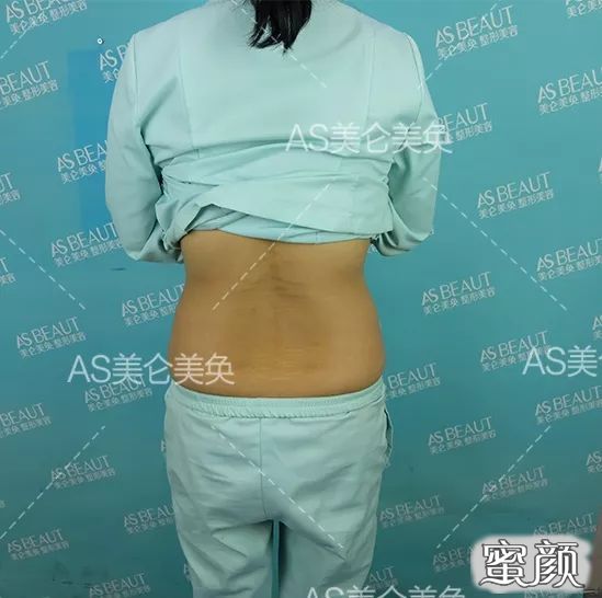 https://img.yiyiaimei.com/mnt/timg/200508/1459414454-10.jpg