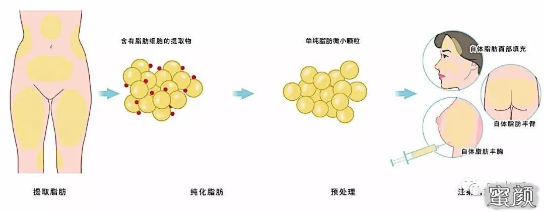 https://img.yiyiaimei.com/mnt/timg/200509/14121135C-2.jpg