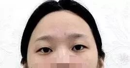 案例图片