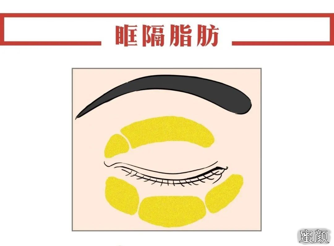 案例图片