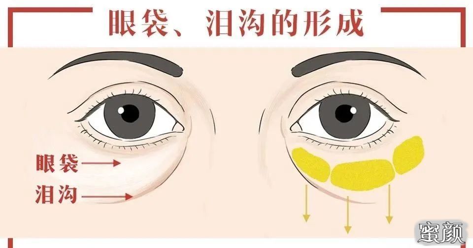 案例图片