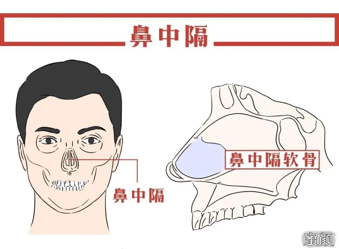 案例图片
