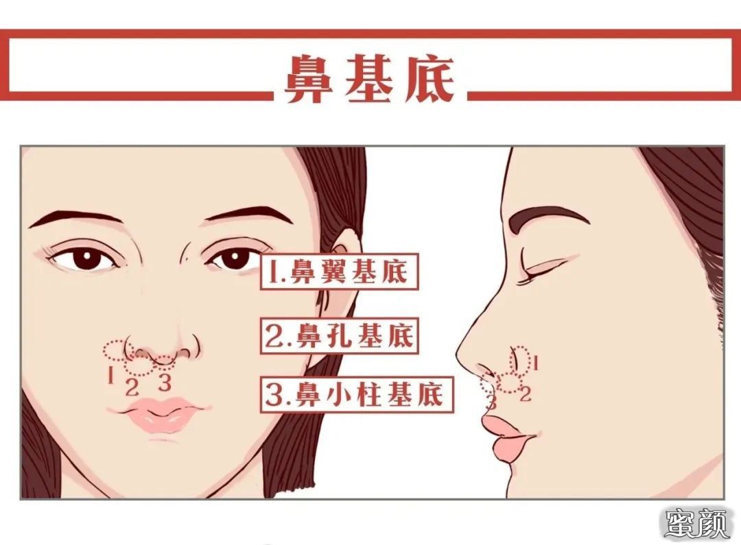 案例图片
