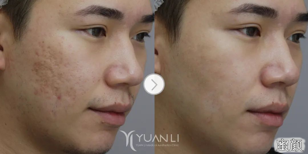 https://img.yiyiaimei.com/mnt/timg/200509/1449153B6-5.jpg 案例图片