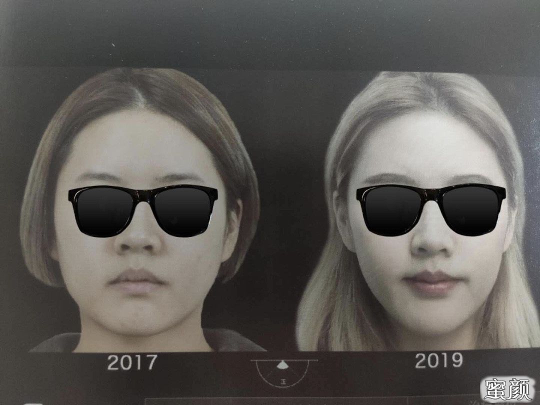 案例图片