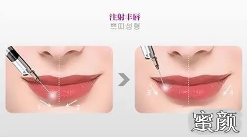 https://img.yiyiaimei.com/mnt/timg/200509/150A11M7-6.jpg 案例图片
