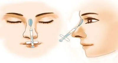 https://img.yiyiaimei.com/mnt/timg/200509/150A31T9-8.jpg 案例图片