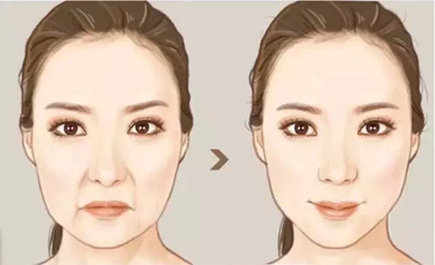 https://img.yiyiaimei.com/mnt/timg/200509/150A32P8-7.jpg 案例图片