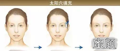 https://img.yiyiaimei.com/mnt/timg/200509/150A34642-9.jpg 案例图片