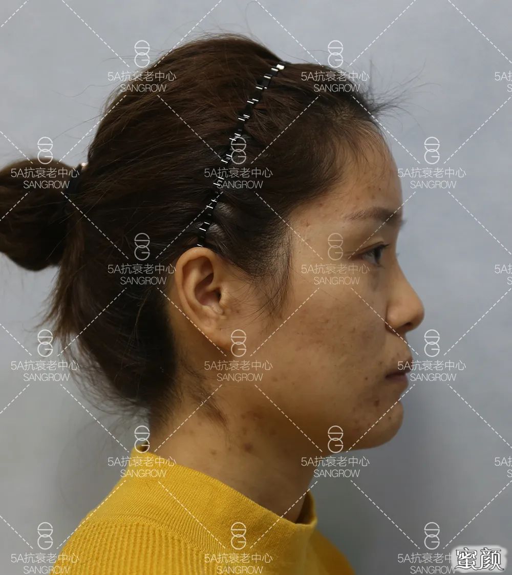 https://img.yiyiaimei.com/mnt/timg/200510/12222VD5-2.jpg