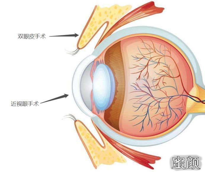 案例图片