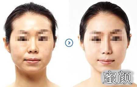 案例图片