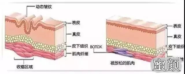 案例图片