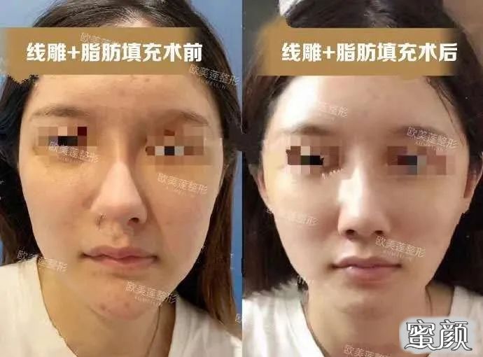 案例图片