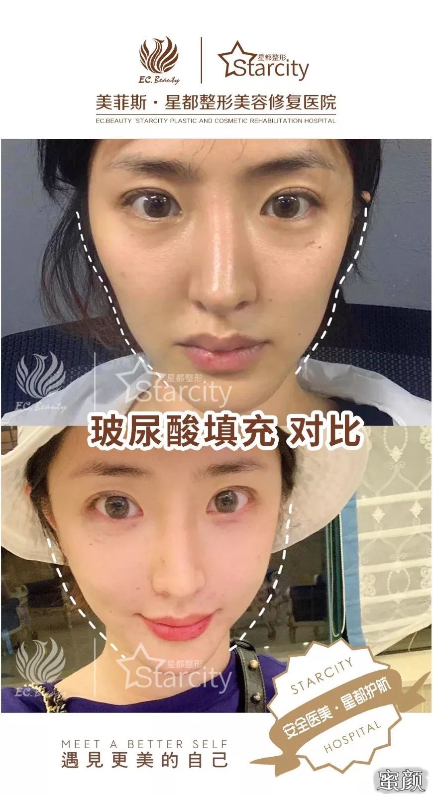 案例图片