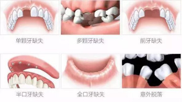 https://img.yiyiaimei.com/mnt/timg/200511/1452331419-1.jpg