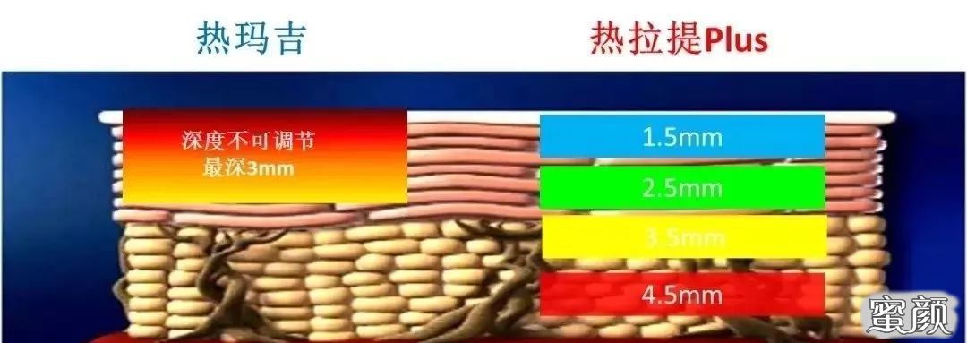 案例图片