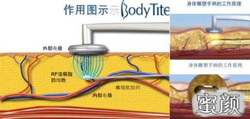 案例图片