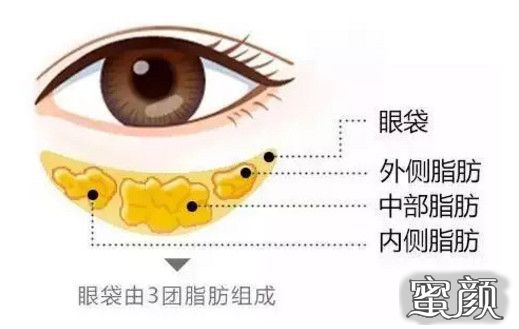 https://img.yiyiaimei.com/mnt/timg/200511/150I9A42-1.jpg