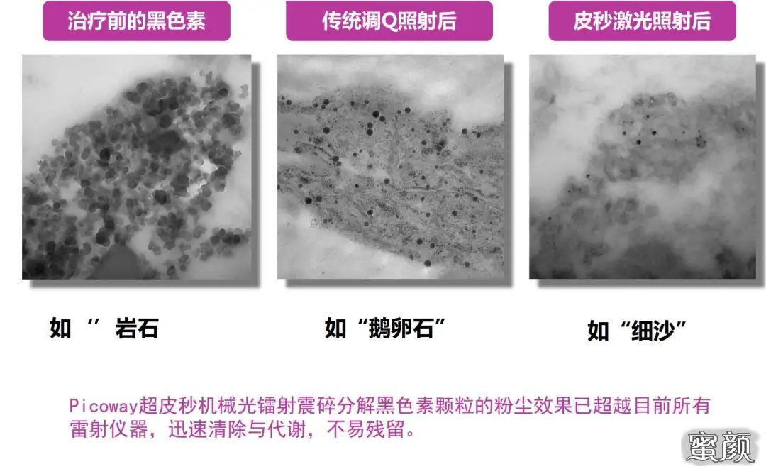 https://img.yiyiaimei.com/mnt/timg/200511/15162G628-6.jpg