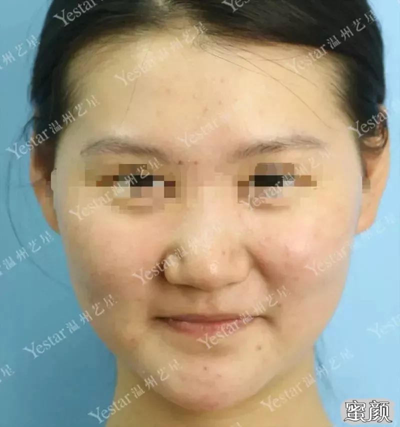 案例图片